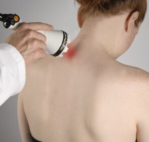 Laserová terapia pomôže zmierniť zápal a aktivovať regeneráciu tkaniva na krku