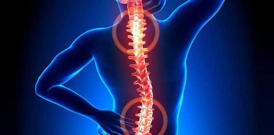 príznaky bolesti chrbta