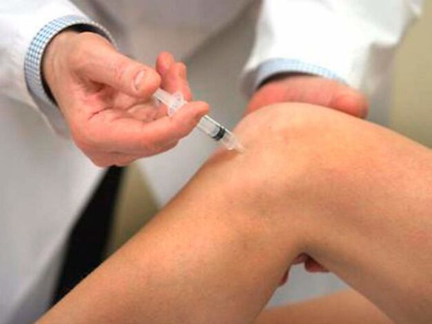 Intraartikulárna injekcia je jednou z najprogresívnejších foriem liečby artrózy kolenného kĺbu