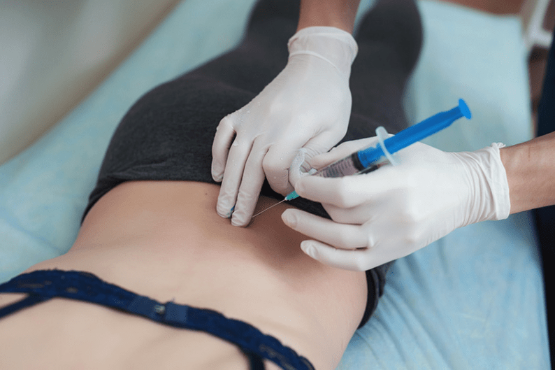 blokáda bedrovej osteochondrózy
