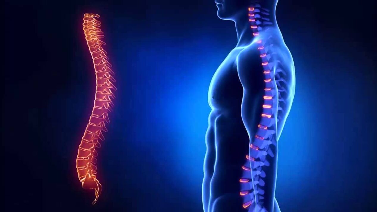 osteochondróza